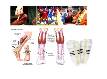 gambar tendon